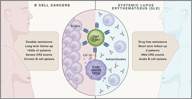 B세포 표면의 CD19 단백질과 결합하는 CAR-T세포(녹색)는 암이 된 B세포가 유발하는 혈액암(왼쪽)뿐 아니라 B세포가 분비하는 항체가 정상 세포까지 공격하는 루푸스 같은 자가면역 질환(오른쪽)도 치료할 수 있다./미 펜실베이니아대