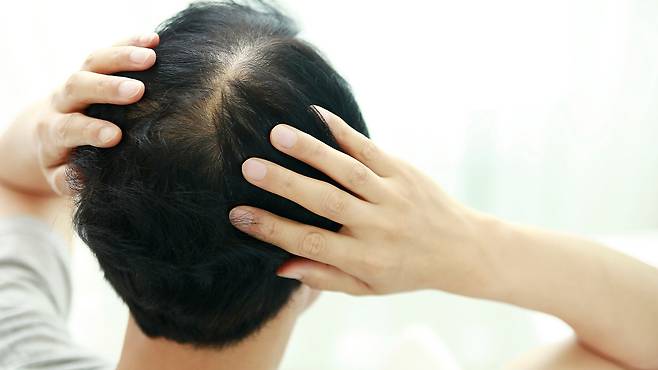 피나스테리드는 디하이드로테스토스테론(DHT) 생성을 억제해 모낭이 더 가늘어지지 않도록 막는다｜출처: 클립아트코리아