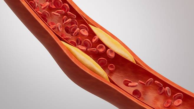 나쁜 콜레스테롤 수치는 낮게 좋은 콜레스테롤은 높게 유지하는 것이 콜레스테롤 수치 관리의 핵심이다 | 출처: 게티이미지뱅크