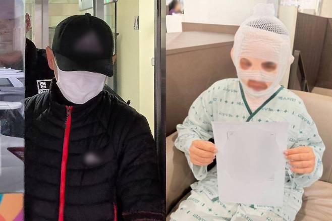 태국인 아내 얼굴에 끓는 물을 부어 화상을 입힌 혐의를 받는 40대 남성이 지난 16일 경기도 의정부지법에서 구속 전 피의자 심문(영장실질심사)을 마치고 나서고 있다. 오른쪽은 서울의 한 병원에서 치료 중인 피해 여성이 도움을 청하는 모습.&nbsp;의정부=뉴스1·사회관계망서비스(SNS) 캡처