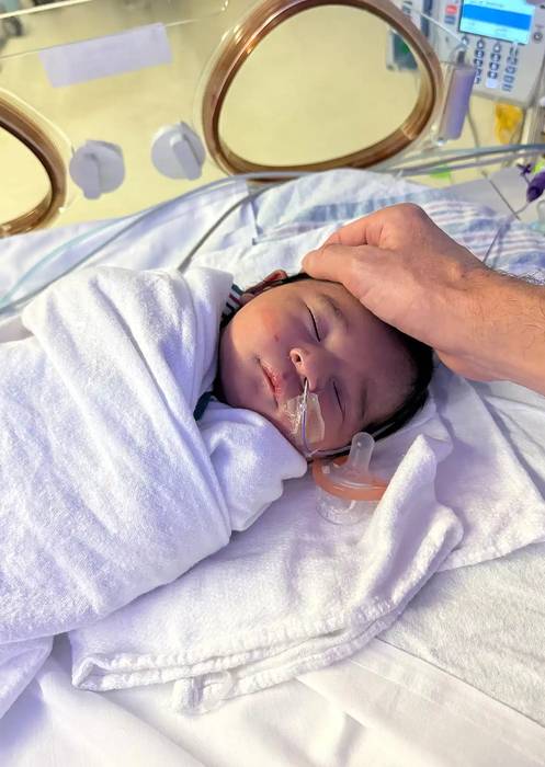 난소 종양을 가진 엄마의 뱃속에서 자궁외임신으로도 건강하게 태어난 아기. 사진=미국 시더스-시나이 병원