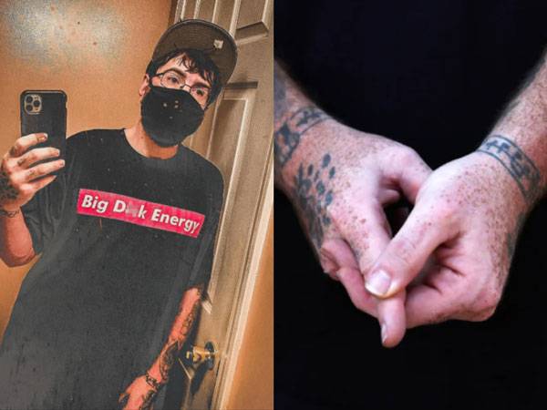 미국의 한 남성이 자신이 '왜소음경증(micropenis)'이라는 희귀한 의학적 상태에 해당한다며, 이로 인해 겪어온 연애와 성생활의 어려움을 털어놔 화제가 되고 있다. 과거 인터뷰에서 그는 손가락으로 자신의 성기 크기를 묘사했다./사진=뉴욕포스트, 더선