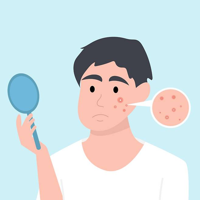 여드름이 나는 원인 가운데 혐기성 세균(여드름균)이나 두꺼운 각질층과 관련된 것은 생활 습관 개선으로 해결될 여지가 있다. GETTYIMGAES