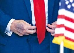 도널드 트럼프 미국 대통령의 손등에 멍이 들어 있다.  /AFP연합뉴스