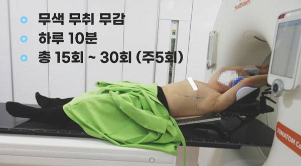 유방암 방사선 치료 현장./사진=성기훈 교수 제공