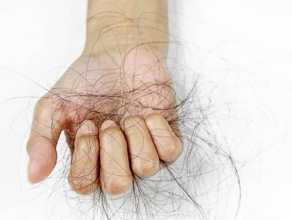 탈모 예방에 도움이 되는 올바른 머리 감기 방법이 전문가에 의해 나왔다. 사진은 본 기사 내용과 무관. [사진=Freepik]