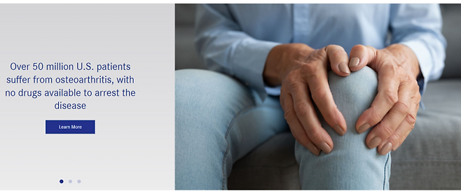 미국 '바이오스플라이스'(Biosplice Therapeutics) 홈페이지. (갈무리=김지완 기자)