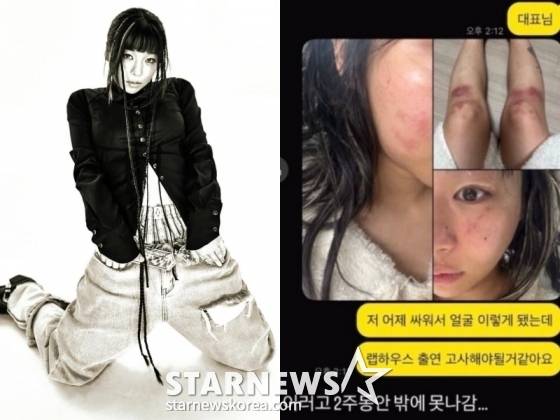 재키와이 /사진=재키와이 SNS