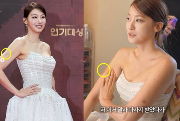유인영이 연말 시상식에서 아름다운 드레스 자태를 뽐낸 가운데 팔의 멍자국 이유를 밝혔다. 사진=유튜브 채널 인연인영 캡처