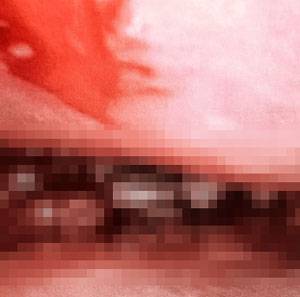 가려움증을 호소한 한 10대 소녀의 코에서 유충이 발견된 사례가 보고됐다./사진=큐레우스