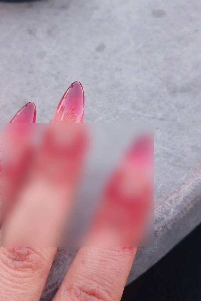 A양이 네일샵 사장 김모씨(53)에게 ″서비스를 받은 후 염증이 났다″며 보낸 사진. AI로 조작된 사진으로 드러났다. 사진 독자