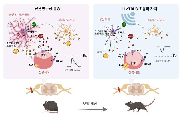 LI-cTBUS가 통증을 완화하는 작동 원리. IBS 제공.