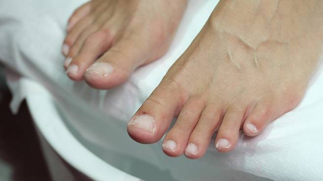 당뇨 환자의 경우 발 감염 초기에 빠르게 대응하지 않으면 피부 괴사로 이어질 수 있다|출처: 클립아트코리아