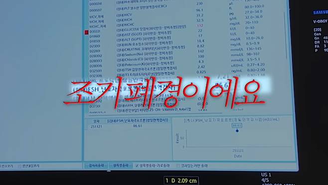 황보라 유튜브 채널 캡처