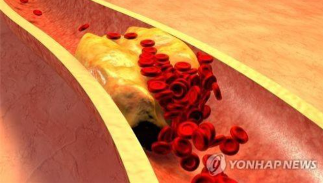 [연합뉴스]