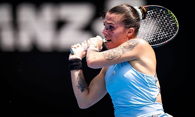 올리니코바는 자신의 팔뚝을 광고판으로 팔기도 했다.