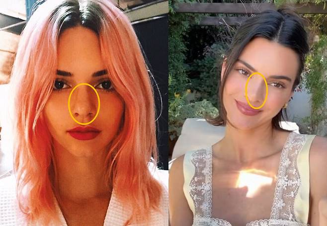 2015년 켄달 제너의 코 모양(왼쪽), 2025년 켄달 제너의 코 모양(오른쪽) /켄달 제너 인스타그램