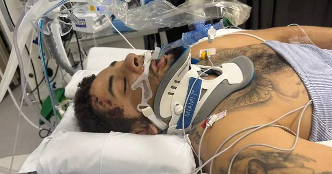 조던 치에도지 수술 후. /사진=영국 BBC 갈무리