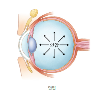 안압은 자세에 따라 변할 수 있으며, 특히 서 있는 자세에서 누운 자세로 바뀌는 수면 시간대에 상승하는 경향이 있다. 서울대병원