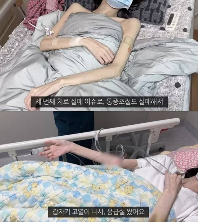 유튜브를 통해 암 투병의 시간을 기록해 온 유튜버 유병장수걸(유병장수girl)이 28세 나이로 세상을 떠났다. 유튜브 채널 ‘유병장수girl’ 캡처