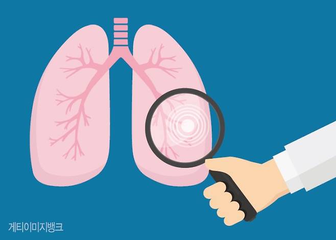 담배 피운 적 없는데... 간접흡연·요리매연에 여성