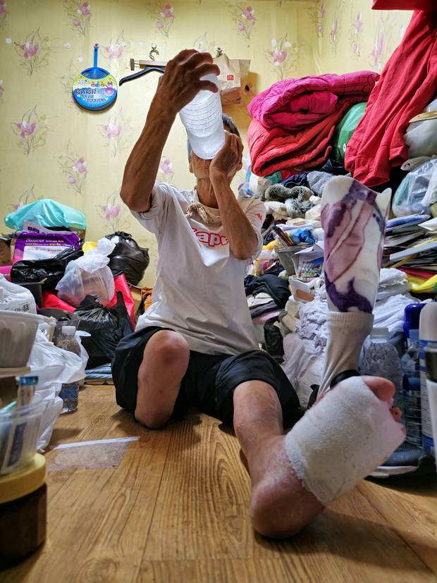 당뇨병으로 한쪽 다리를 잃은 권모씨. 이강산 사진가 제공