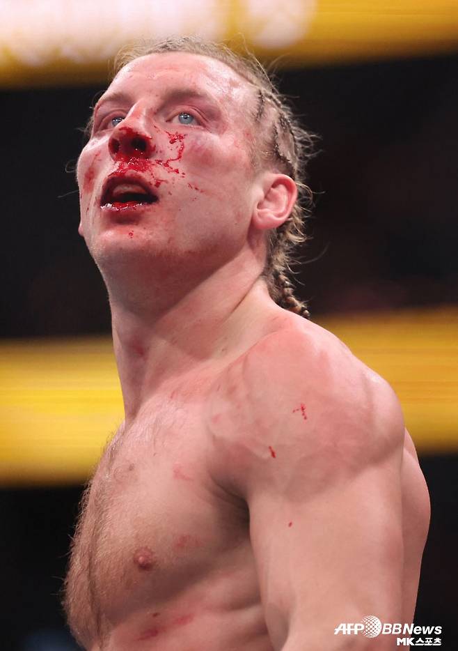 패디 핌블렛. 사진=AFPBBNews=News1