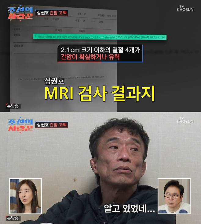 심권호 / 사진=TV CHOSUN 조선의 사랑꾼