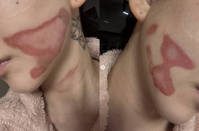 권민아. 사진| SNS