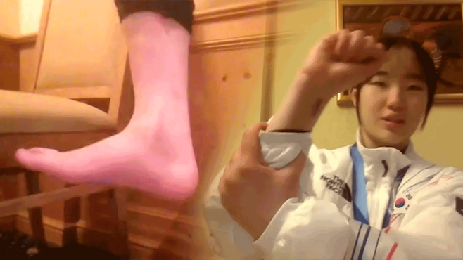 화상 인터뷰에서 손목과 발목 수술의 흉터를 취재진에게 보여준 유승은은 주변에서 많은 도움을 줬기에 이겨낼 수 있었다며 감사 인사를 전했습니다.