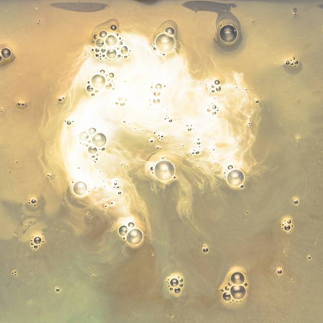 콩팥은 우리 몸의 노폐물을 걸러내는 필터 역할을 하지만, 이 기능이 손상되면 단백질이 소변으로 새어 나오는 단백뇨 증상이 나타난다. freepik 제공