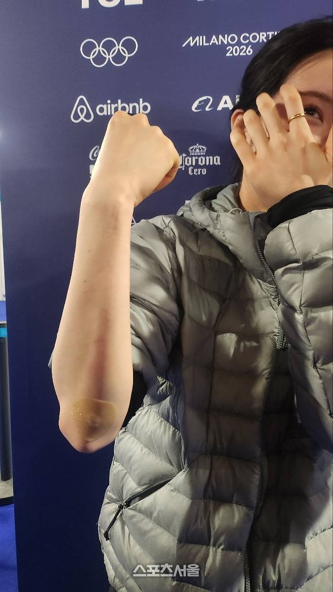 한국 쇼트트랙 여자 대표팀 김길리가 11일 취재진에게 팔 부상 부위를 보여주고 있다. 밀라노 | 김민규 기자 kmg@sportsseoul.com