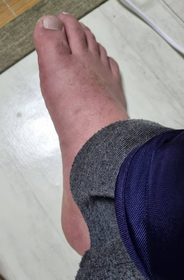 마사지기 공기압이 부풀려져 종아리나 허벅지에 압력이 가해지면 피가 순간적으로 통하지 않는다. 압력이 풀리면 한꺼번에 피가 흐른다. 압력이 가해져 일시적으로 족부에 피가 쏠려 약간 빨갛게 보인다. 정옥재 기자