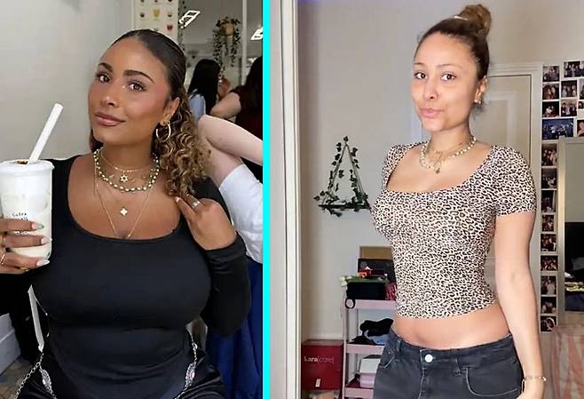 프랑스의 한 20대 여성이 유방축소술을 받게 된 사연을 공개했다./사진=니드투노우