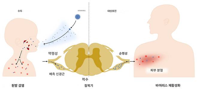 어릴 때 수두-대상포진 바이러스(VZV)에 감염되면 온몸에 물집과 발진이 생기는 수두가 발생한다(왼쪽). 바이러스는 척수 신경세포에 잠복하고 있다가(가운데) 성인이 돼서 면역력이 약해졌을 때 다시 증식해 피부의 국소적인 부분인 피부분절에 띠 모양 물집과 극심한 통증을 유발하는 대상포진을 일으킨다(오른쪽)./MDPI