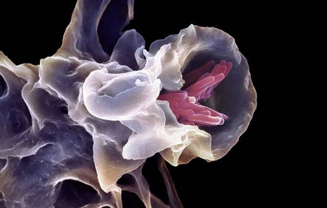 대식세포가 결핵균을 삼키는 과정. 사이언스 포토 라이브러리