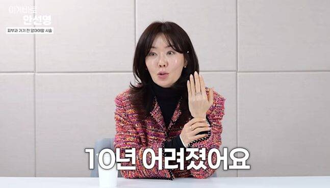 안선영이 손이 어려 보이는 시술을 밝혔다. 사진=유튜브 채널 '이게 바로 안선영' 캡처