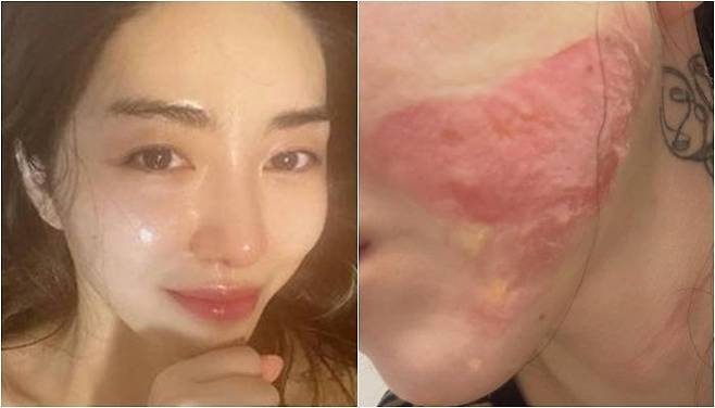 /사진=권민아 SNS