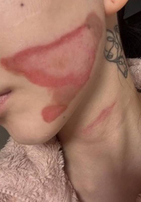 /사진=권민아 SNS