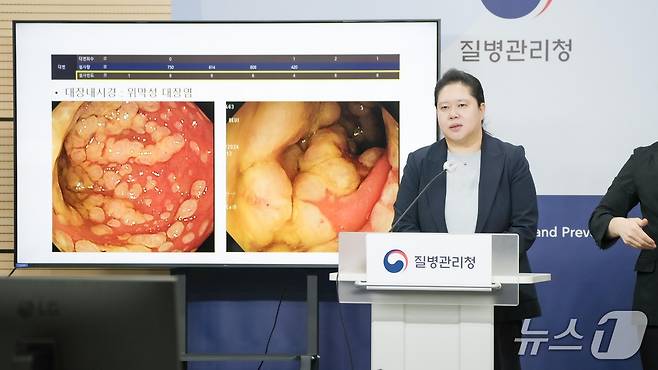 25일 충북 청주 질병청사에서 열린 '제3차 항생제 내성 관리대책' 브리핑에서 문송미 분당서울대병원 교수가 항생제 내성 사망의 심각성을 발표하고 있다.(질병청 제공)