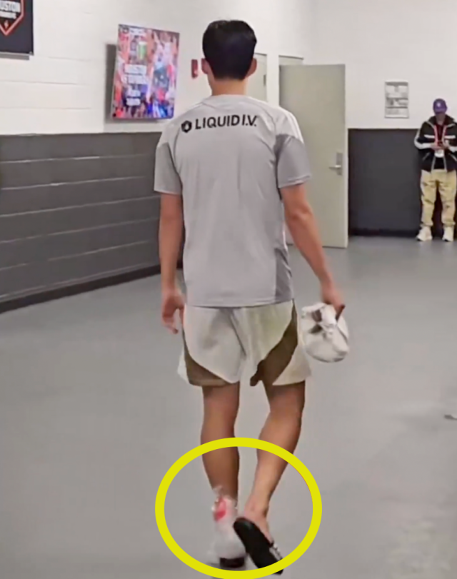 아이싱을 한 손흥민/올레 USAMEX