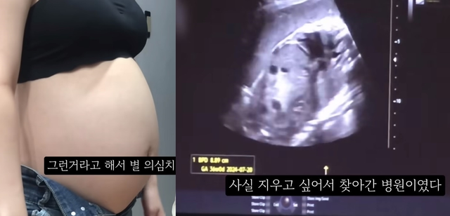 지난 2024년 6월 20대 여성 유튜버가 임신 36주차 태아의 초음파 사진을 공개하면서 낙태사실을 고백해 ‘영아 살해’ 논란에 휩싸였고, 이후 해당 여성과 임신중절수술을 한 병원 등으로 수사가 전개됐다.[유튜브 출처]