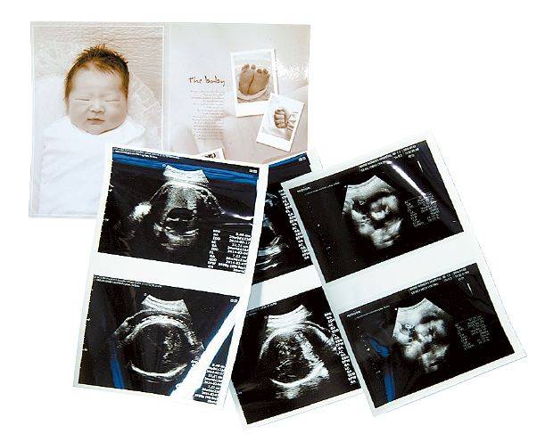 이주호 학생기자 출생 관련 물품