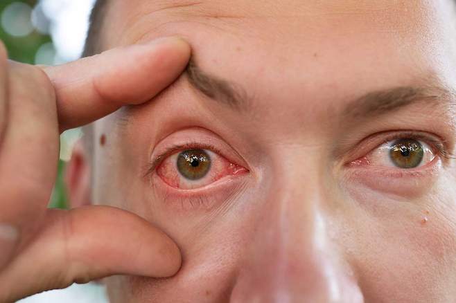 눈동자 색이나 모양, 부종 등의 작은 변화는 만성질환의 신호일 수 있어 주의가 필요하다./사진=클립아트코리아