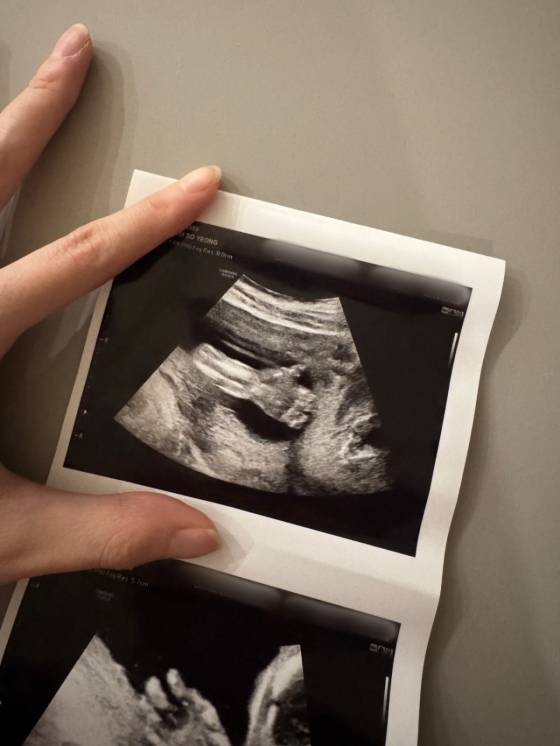 /사진=김소영 SNS