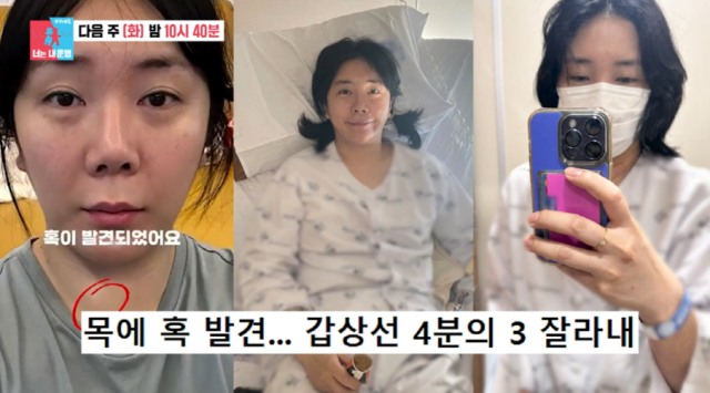 개그우먼 허안나 부부의 예고편이 공개되어 이목을 집중시켰다./ SBS '동상이몽2-너는 내 운명'