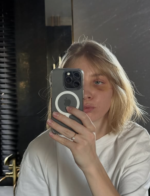 ▲ 선두를 달리던 셀리에르는 이탈리아의 아리아나 폰타나에게 추월을 허용한 뒤 코너 구간에서 균형을 잃었다. 이 과정에서 뒤따르던 미국의 크리스틴 산토스 그리스월드의 스케이트 날이 우발적으로 셀리에르의 왼쪽 눈 위를 스치며 큰 부상으로 이어졌다.