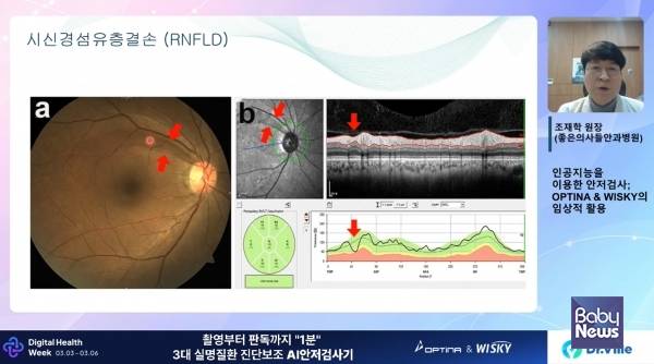 디지털헬스위크 2026에서 연자가 강연을 하고 있다. ⓒ대웅제약