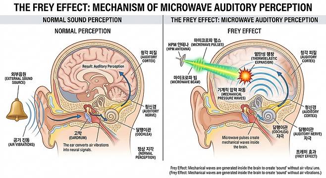 도널드 트럼프 미국 대통령이 언급한 디스컴버뷸레이터의 원리로 지목되는 프레이 효과를 묘사한 이미지. 왼쪽은 정상적인 상태고, 오른쪽은 프레이 효과를 겪은 상태다.&nbsp;위 사진은 기사 이해를 돕기 위해&nbsp;AI(인공지능)를 활용해 생성된 가상의 이미지다. 제미나이 생성 이미지