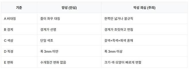 흑색종 구별 기준 표